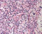 RPS6KB1 / P70S6K / S6K Antibody (C-Terminus)